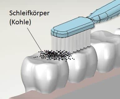 Aktivkohle auf Zähne